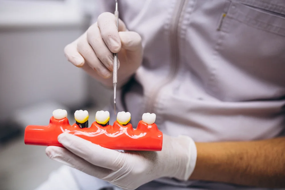 dentista sujetando modelo dientes con periodoncia