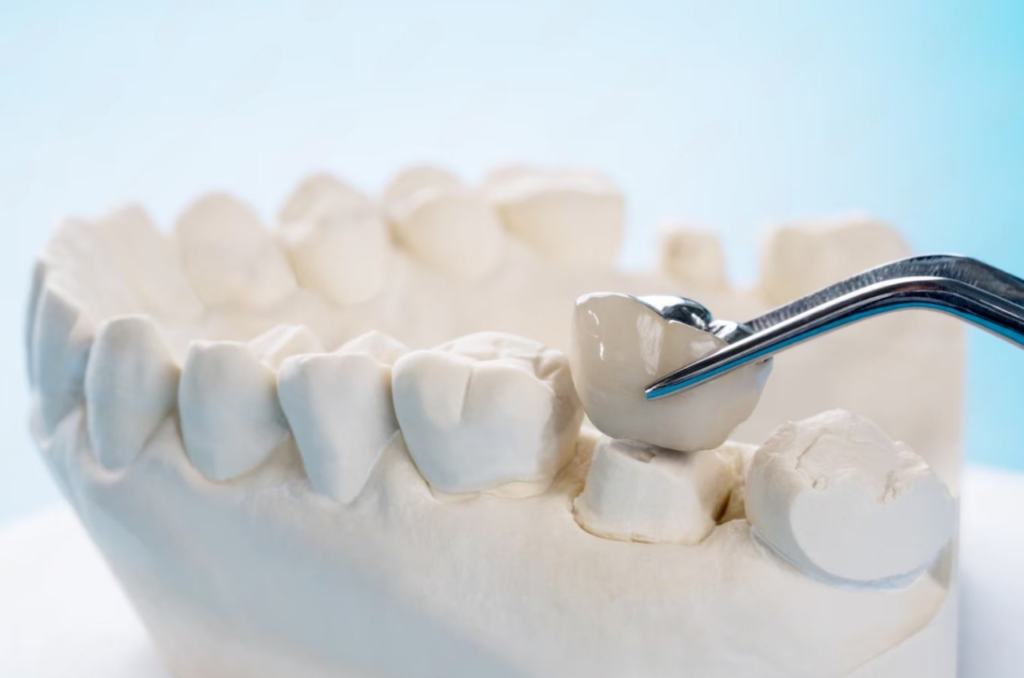 ajuste corona dental en modelo protesis clinica